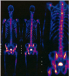 sistema Osteoarticular